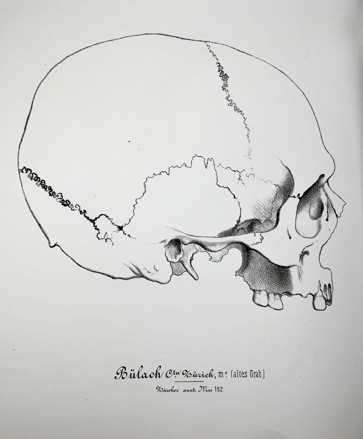 1864 Rutimeyer & His, Crania Helvetica, 82 stone lithographs, sole edition, anatomy, book