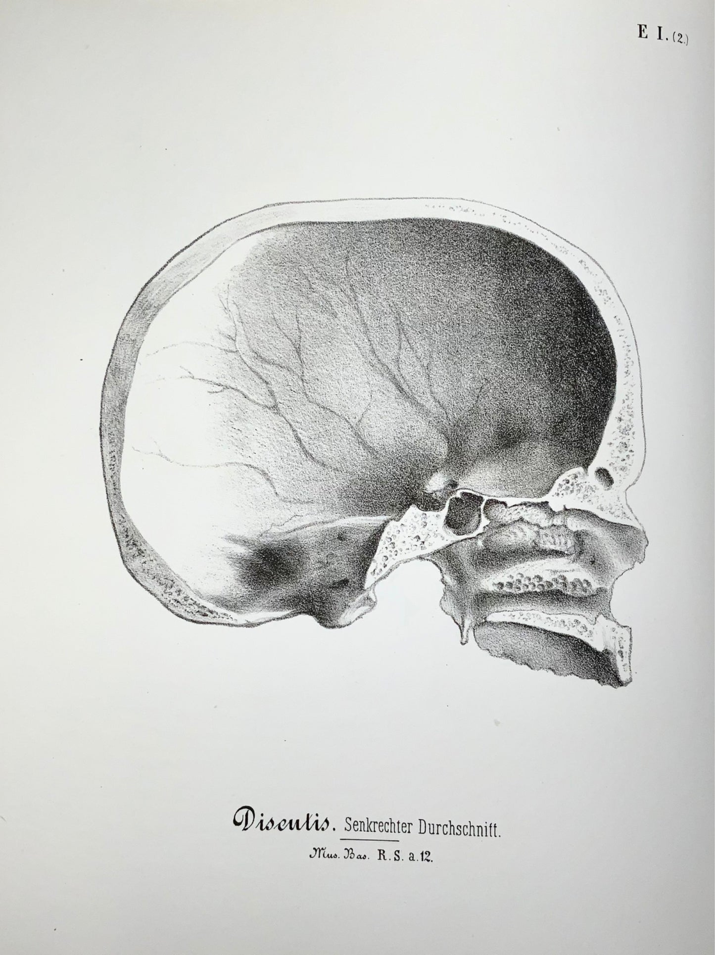 1864 Rutimeyer & His, Crania Helvetica, 82 stone lithographs, sole edition, anatomy, book